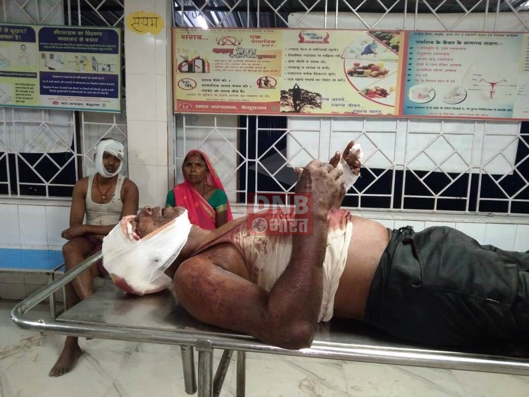 बरौनी पिपरा देवस पंचायत में मारपीट, मुखिया समेत तीन गम्भीर रूप से घायल 2