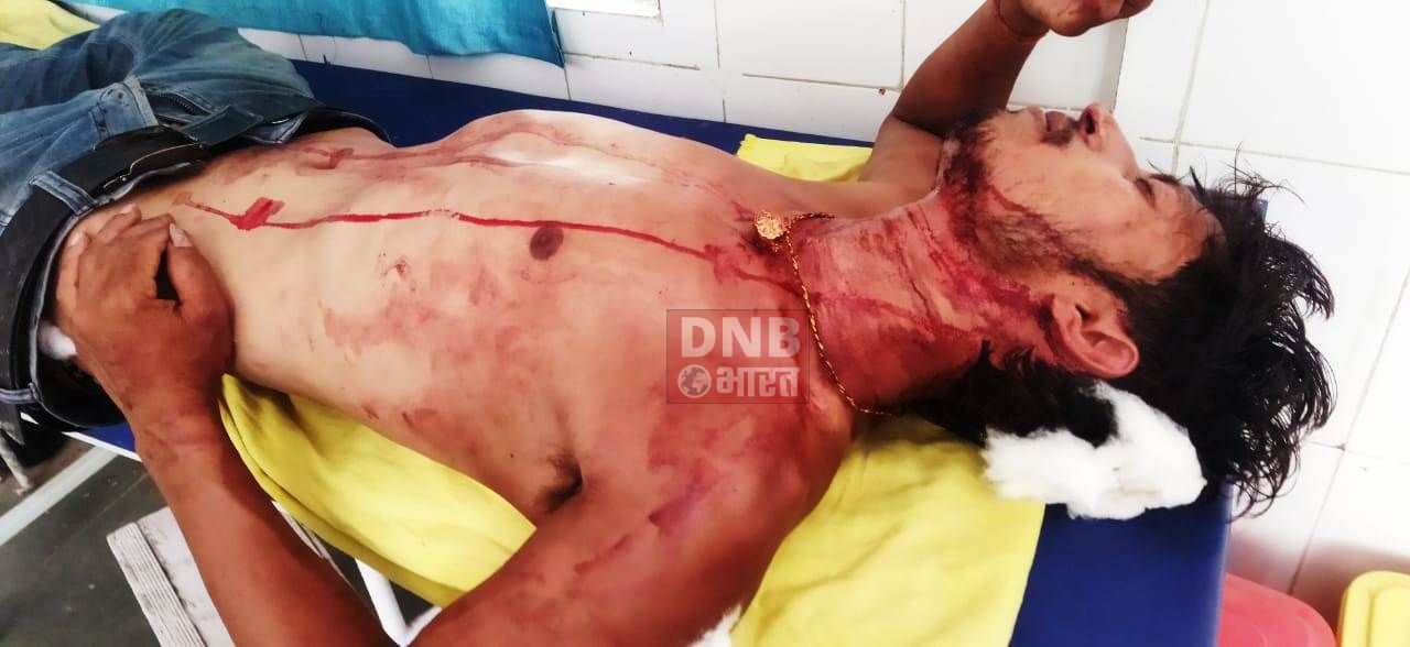 रास्ता विवाद को लेकर दो पक्षों के मारपीट में गर्भवती महिला समेत आठ लोग जख्मी 2