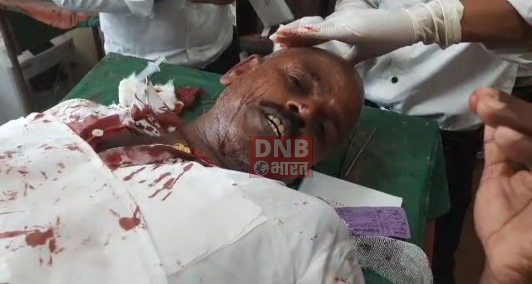सुशासन की सरकार...अवैध शराब बेचने का विरोध करने पर पूर्व जिप सदस्य को बदमाशों ने जमकर पीटा और मारी गोली 2