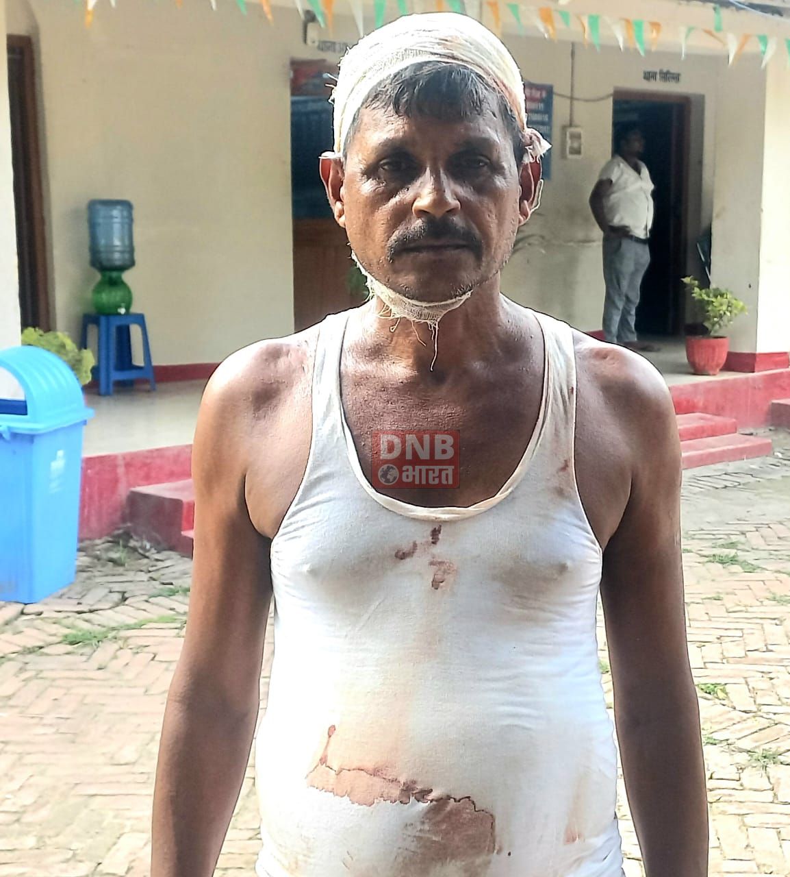 नन बैंकिंग कंपनी के किश्त का रूपया नहीं देने पर पुत्र ने पिता पर ईट से किया हमला,पिता जख्मी 2