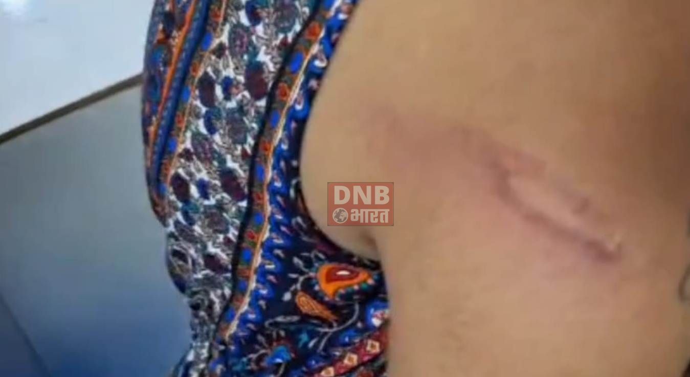 बेगूसराय में दबंगों ने दो छात्राओं समेत उनकी मां की जमकर की पिटाई,सदर अस्पताल में चल रहा है इलाज 2