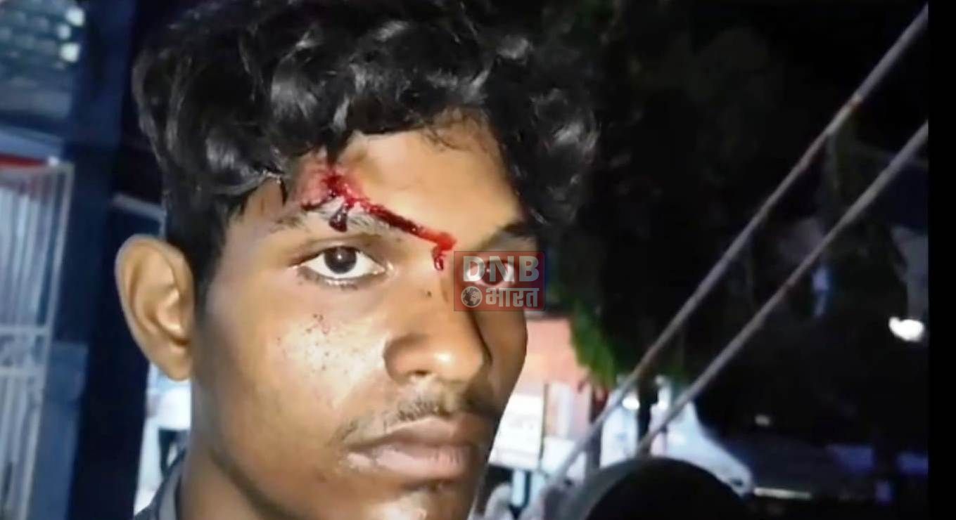 बेगूसराय में पैसे के लेन देन को लेकर दो पक्षों के बीच मारपीट में तीन सहोदर भाई घायल 2