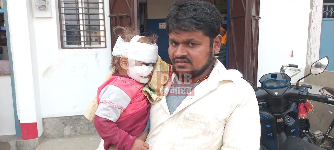 बछवाड़ा में अनियंत्रित ऑटो ने बाइक में पीछे से मारी ठोकर, बाइक चालक समेत पांच लोग घायल 4