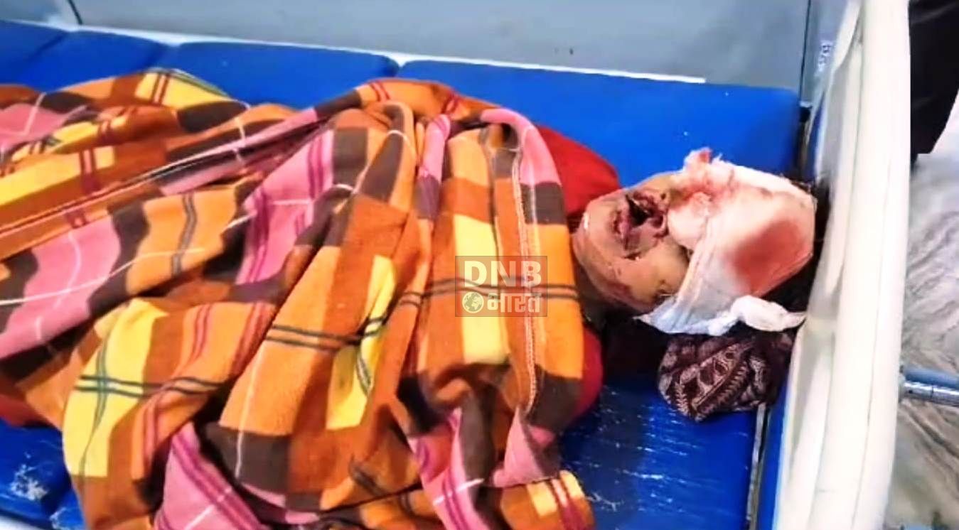 सड़क किनारे खड़े ट्रक को अनियंत्रित पिकअप वैन ने पीछे से मारी टक्कर; चालक एवं महिला समेत तीन लोग जख्मी,दो की स्थिति नाजुक 2