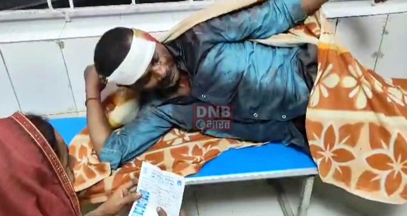 बेगूसराय में देवर भाभी के अवैध संबंध का चाचा ने किया विरोध,तो भतीजे ने किया जमकर धुनाई 2