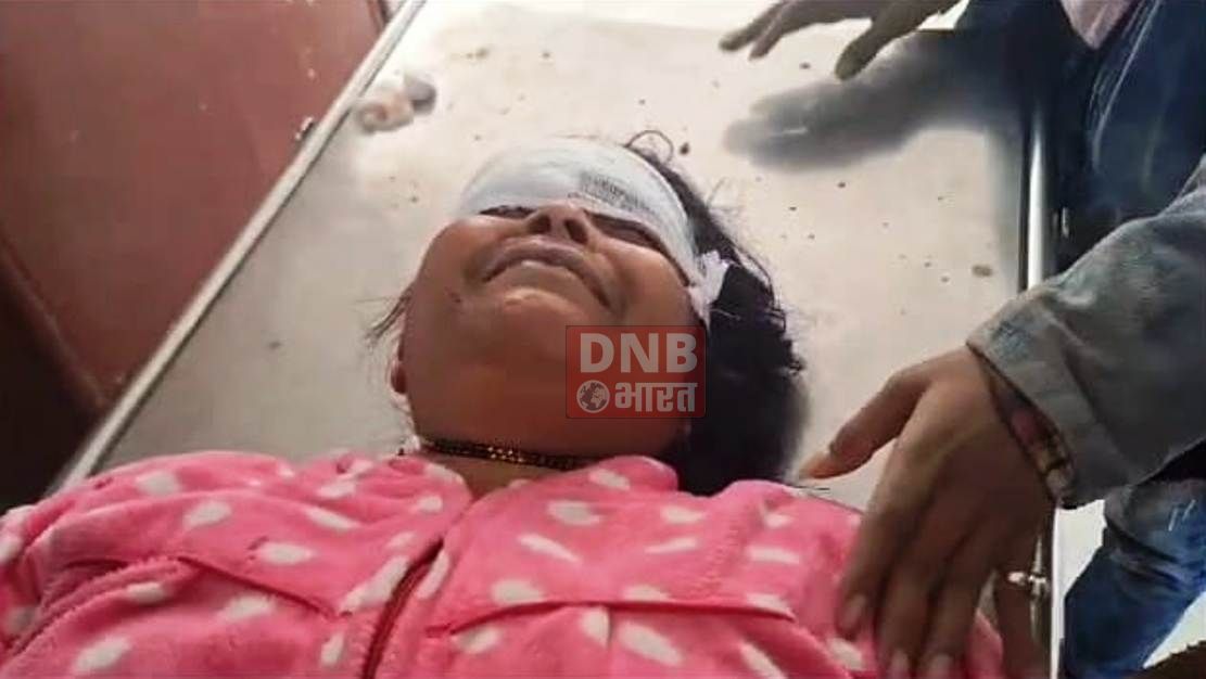 बेगूसराय मे आपसी विवाद को लेकर लाठी डंडे से पिटाई मामले में दो संगे भाई समेत तीन लोग घायल 3