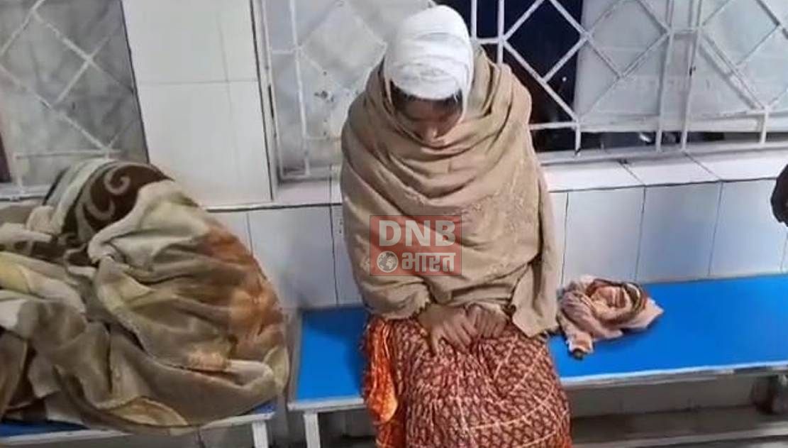 बेगूसराय में जमीनी विवाद एक महिला को ईट पत्थर से पीट कर किया घायल, सदर अस्पताल में भर्ती 2