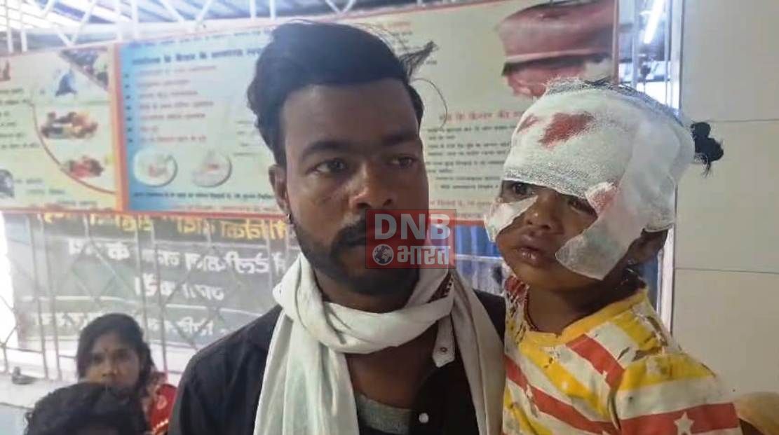 बेगूसराय में गीदर का आतंक, चार बच्चो को बनाया निशाना, सभी बच्चे अस्पताल में भर्ती 3