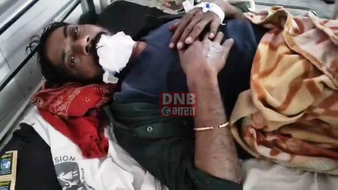 बेगूसराय में भीषण सड़क हादसे में तीन लोग गंभीर रूप से घायल,सदर अस्पताल में भर्ती 3