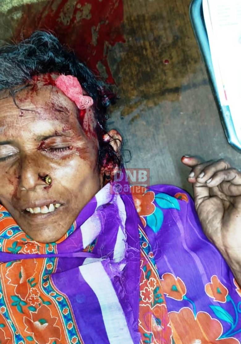 अनियंत्रित बाइक की ठोकर से वृद्ध महिला घायल,निजी अस्पताल में भर्ती, मामला दर्ज 2