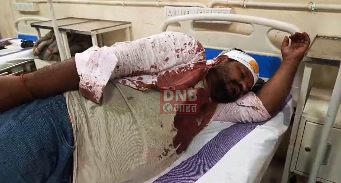 बॉलीबाल खेलने के विवाद को लेकर दो पक्षों ने आपस में की मारपीट, दोनो पक्षों से एक दर्जन जख्मी,पुलिस घटनास्थल पर पहुंचकर जांच में जुटी 2