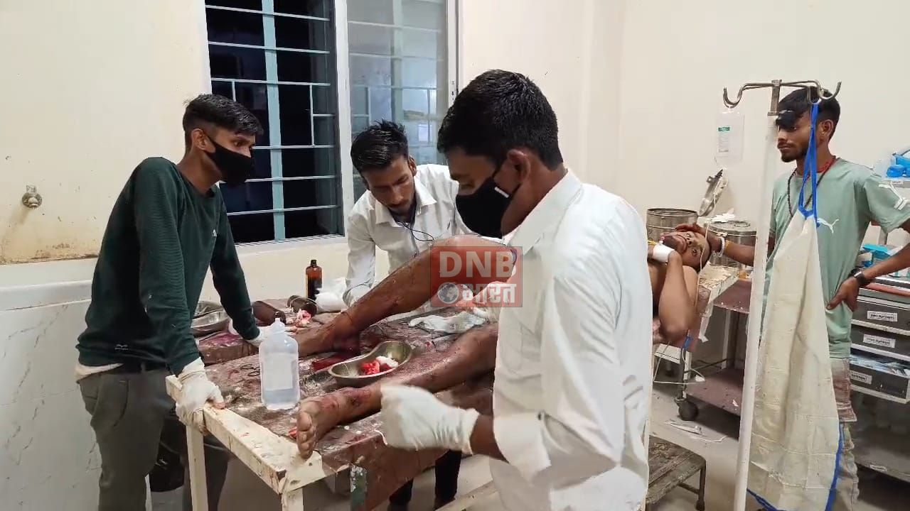 पूर्व के रंजिश में युवक के ऊपर हुआ जानलेवा हमला, गोलीबारी के दौरान युवक के पैर में लगी गोली 2