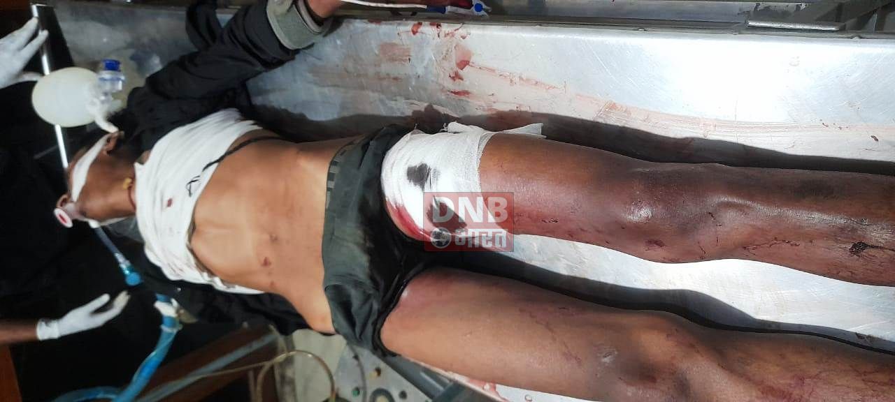 गोली लगने से एक युवक गंभीर रुप से घायल, युवक का निजी अस्पताल में चल रहा है इलाज, मामले में पुलिस व फोरेंसिक टीम कर रही है जांच 3