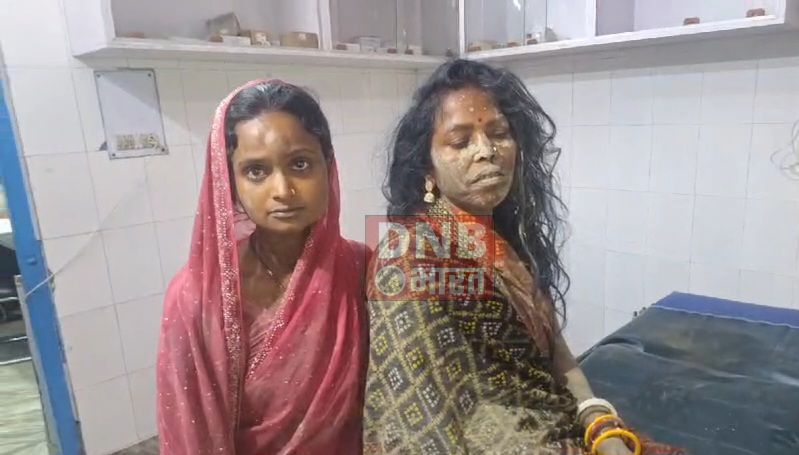 बेगूसराय में मामूली बात को लेकर दबंगो ने किसान सास बहू की जमकर की पिटाई, पुलिस मामले की जांच में जुटी 2