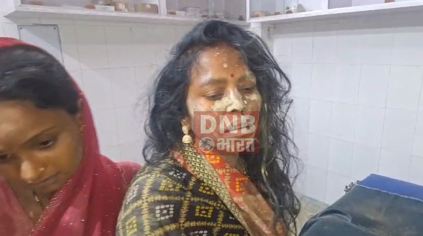 बेगूसराय में मामूली बात को लेकर दबंगो ने किसान सास बहू की जमकर की पिटाई, पुलिस मामले की जांच में जुटी 3