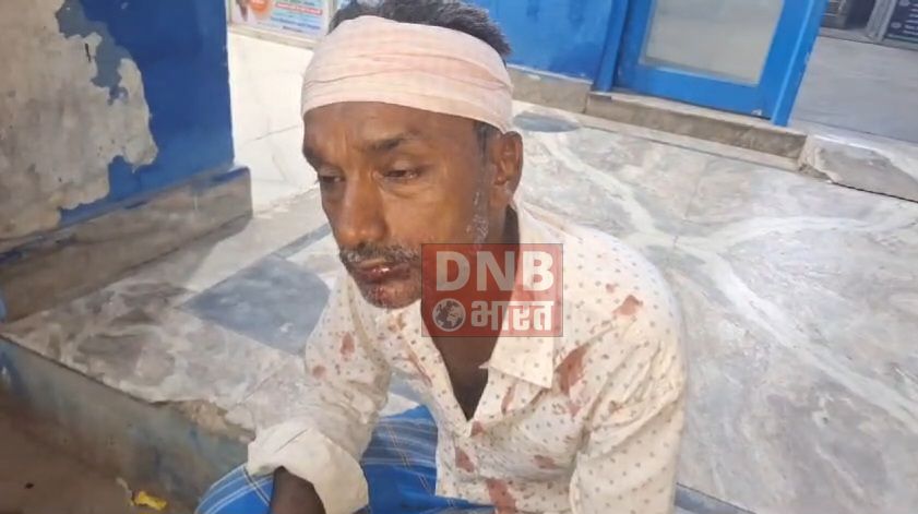 बेगूसराय में प्रेम प्रसंग मामले में हुई मारपीट में लड़की पक्ष वालों ने लड़के के पिता को पीट-पीट कर किया अधमरा , सदर अस्पताल में भर्ती 2