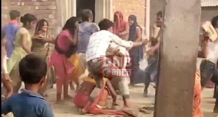 बेगूसराय में जमीनी विवाद में दबंग पड़ोसी ने घर मे घुसकर महिला के साथ किया जमकर पिटाई, सदर अस्पताल में भर्ती 3