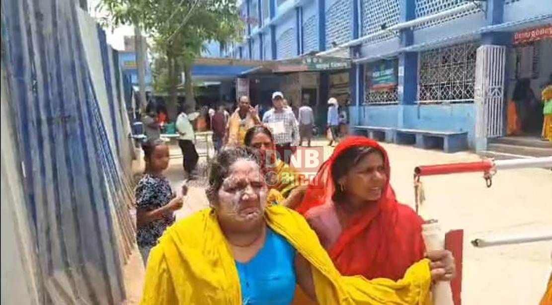 चुल्हे पर खाना बनाने के दौरान घर में लगी आग,सांस व बहु गंभीर रुप से घायल,सदर में चल रहा ईलाज,परिजनों में मचा कोहराम 2