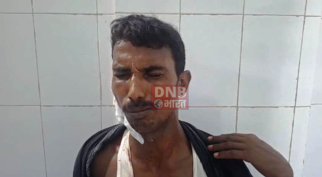 बेंखौफ अपराधियों ने एक युवक को धारदार हथियार से हमला कर किया गंभीर रूप से घायल, पुलिस कर रही जांच 2