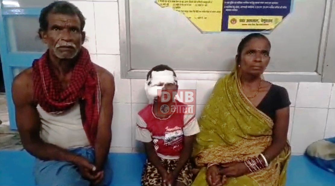 बेगूसराय में खूंखार कुत्ता ने दो दर्जन से अधिक लोगों को काटकर किया घायल, घायलों में महिला-पुरुष सहित बच्चे भी शामिल 2