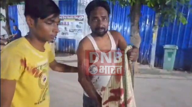 बेगूसराय में 10 लाख रुपए की मांग को लेकर सगे भाई एवं भाभी ने अपने ही भाई को चाकू मार कर किया गंभीर रूप से घायल, सदर अस्पताल में भर्ती 2