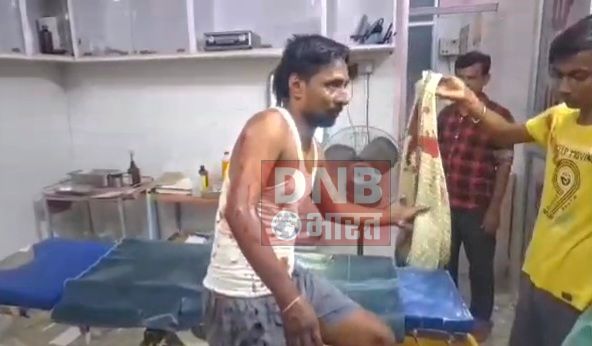 बेगूसराय में 10 लाख रुपए की मांग को लेकर सगे भाई एवं भाभी ने अपने ही भाई को चाकू मार कर किया गंभीर रूप से घायल, सदर अस्पताल में भर्ती 3