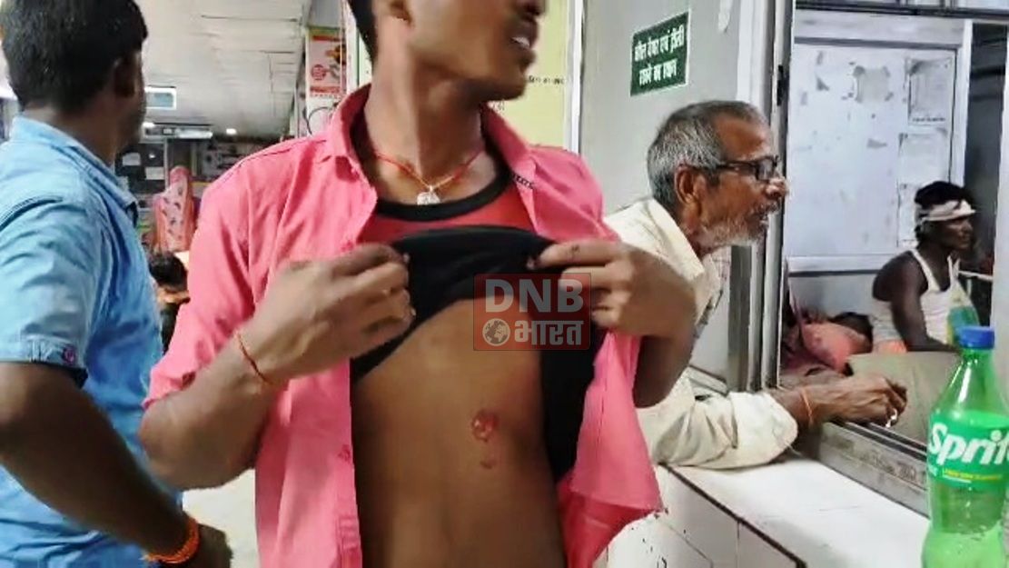 बेगूसराय में जमीनी विवाद में दबंग ने घर में घुसकर किया पुरे परिवार की जमकर पिटाई, चार लोग गंभीर रूप से घायल 3