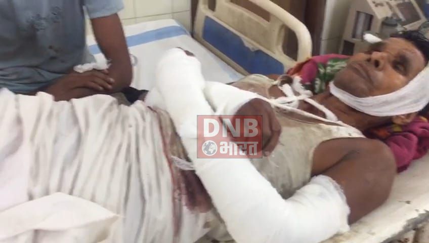 समस्तीपुर: जमीनी विवाद को लेकर पड़ोसी ने पिता-बेटे से सहित घर के अन्य सदस्य को लाठी डंडे से हमला कर बुरी तरह से किया घायल, सदर अस्पताल में भर्ती 2