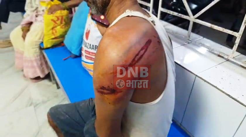 बेगूसराय मे फसल काटने का विरोध किया तो दबंगों ने खेत मालिक की जमकर पिटाई, घायल सदर अस्पताल में भर्ती 2