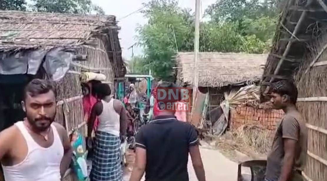 बेंखौफ अपराधियों ने एक युवक के ऊपर मिट्टी का तेल छिड़कर जिंदा जलाकर मारने का किया, प्रयास, युवक बुरी तरह से जलकर गंभीर रूप से घायल 3
