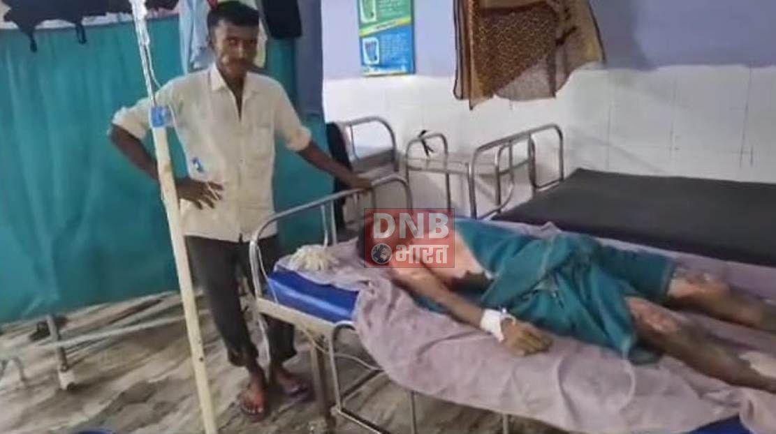 बेंखौफ अपराधियों ने एक युवक के ऊपर मिट्टी का तेल छिड़कर जिंदा जलाकर मारने का किया, प्रयास, युवक बुरी तरह से जलकर गंभीर रूप से घायल 2