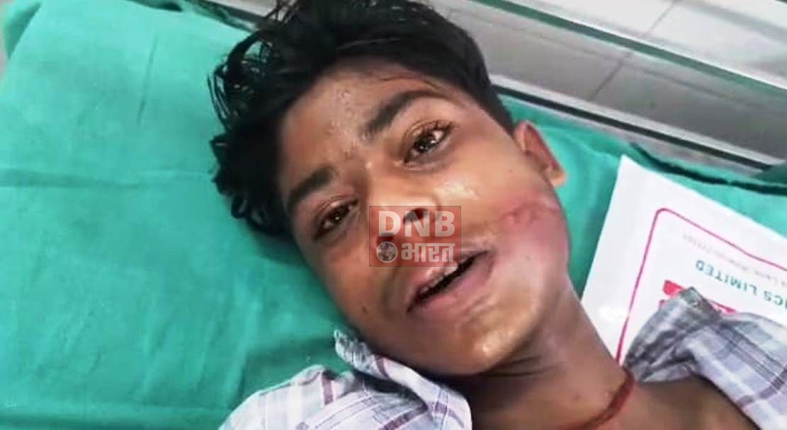 बेगूसराय में बदमाशों ने नाबालिग छात्र का अपहरण के बाद पिटाई कर झाड़ियों में छोड़कर हुआ फरार 2