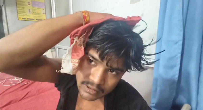 बेगूसराय मे मोबाइल के फीचर को लेकर दुकानदार और ग्राहक के बीच जमकर मारपीट, दुकानदार और ग्राहक दोनों बुरी तरह घायल  1