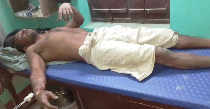 बेगूसराय शाम्हो में आग लगने से एक मवेशी की गयी जान,पिता पुत्र झुलसे,पुत्र की स्थिति नाजुक 2