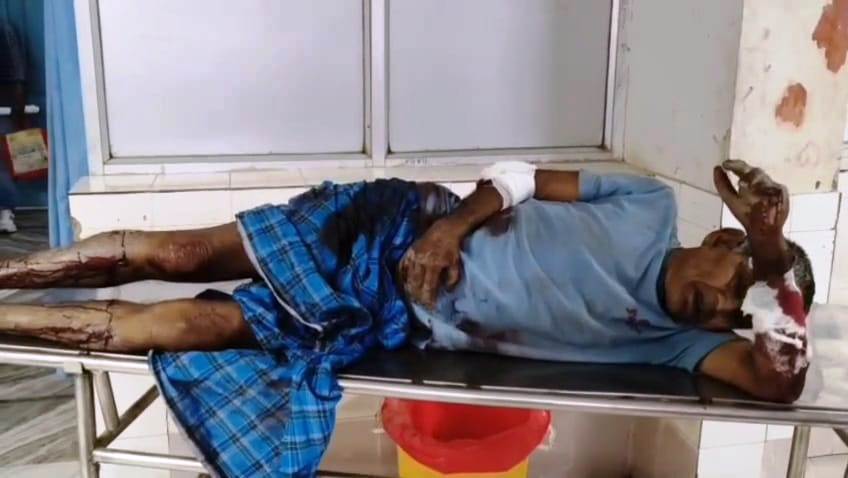 बेगूसराय में दबंगों ने घर में घुसकर पिता ओर पुत्र को लाठी डंडे से बेहरमी से किया पिटाई 2
