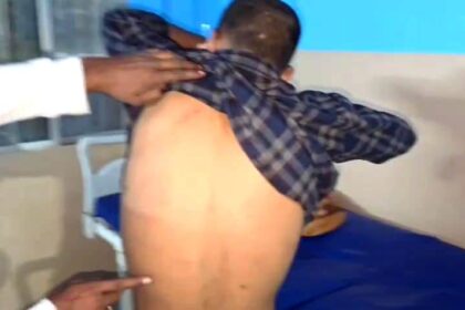 पुलिस की बर्बरता का खौफनाक चेहरा आया सामने, मामूली बात को लेकर पुलिस ने तीन युवक की बेरहमी से किया पिटाई 8