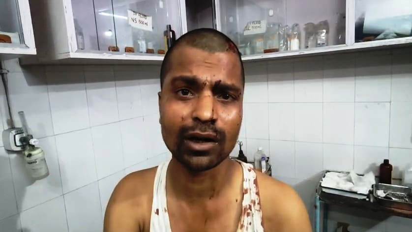 बेगूसराय में बेटे की पिटाई कर रहे चाचा से चचेरे भाई को बचाने पहुंचा तो चाचा ने भतीजे की कर दी पिटाई 7