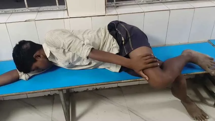 बेगूसराय में मवेशी के चारा पर चढने से नाराज पिता ने पुत्र की बेरहमी से की पिटाई, पुत्र गंभीर रूप से घायल 2