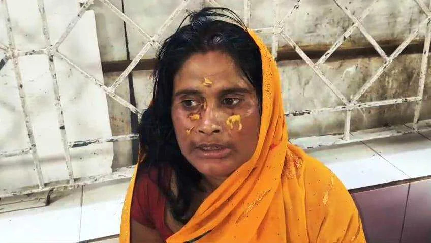 बेगूसराय मे जमीन विवाद मे अपने ही रिस्तेदार मारपीट, महिला समेत कई लोग घायल,सदर अस्पताल में भर्ती 2