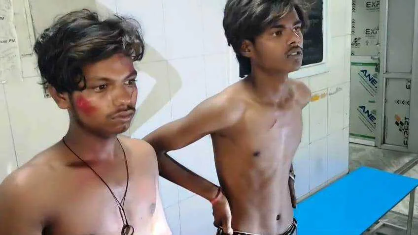 बेगूसराय में दोस्त की बहन के साथ छेड़खानी का विरोध करना दो युवक को पड़ा महंगा, बेल्ट और लाठी डंडे से बेरहमी से किया पिटाई 1