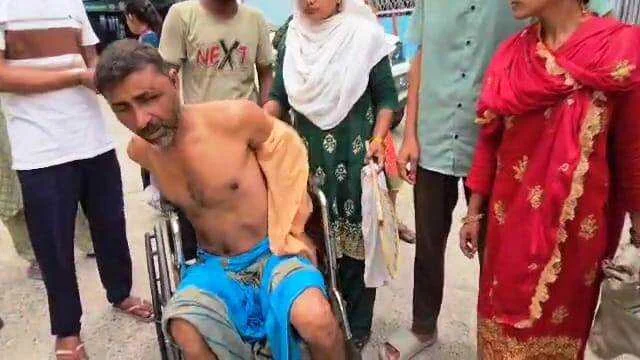 बेगूसराय में बकाया रुपया मांगने पर दबंगों ने हाथ पैर बांधकर बेहरमी से लाठी डांटे एवं लोहे की रॉड से पीट-पीट कर किया गंभीर रूप से घायल 2