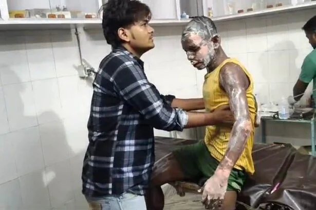 बेगूसराय मे चाय बनाने के दौरान गैस की लपते से एक युवक झुलसा, सदर अस्पताल में भर्ती   7