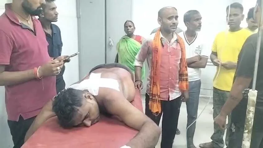 कैमूर में बेलगाम अपराधियों ने दुकानदार को मारी गोली, घायल दुकानदार वाराणसी ट्रामा सेंटर रेफर  2