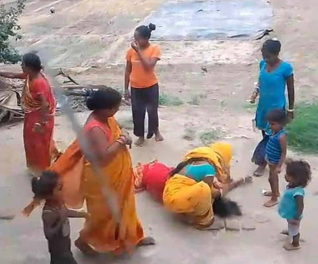 बेगूसराय मे गोतनी ने अपने बच्चों के साथ मिलकर गोतनी की कर दी पिटाई, घायलावस्था में चल रहा है इलाज 7