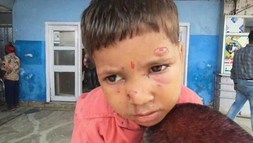 बेगूसराय के दियारे में गंगा का जलस्तर बढ़ते ही गीदड़ का आंतक बढ़ा, बच्चे को बनाया शिकार, लोगों में भय व्याप्त 13
