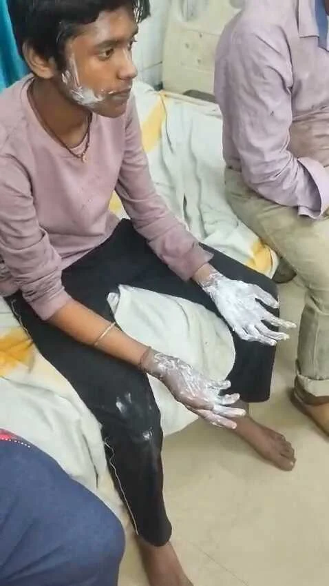 समस्तीपुर: दलसिंहसराय के काली स्थान मोहल्ला में बिजली शॉर्ट सर्किट से लगी भीषण आग, परिवार के दो बच्चे झुलसे  3