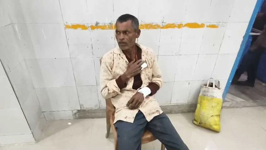 बेगूसराय में गीदड़ का आतंक: नावकोठी में एक दर्जन लोगों को काटकर किया लहूलुहान, वन विभाग से मदद की गुहार 1