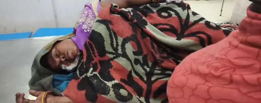 बेगूसराय में गीदड़ का आतंक: नावकोठी में एक दर्जन लोगों को काटकर किया लहूलुहान, वन विभाग से मदद की गुहार 2