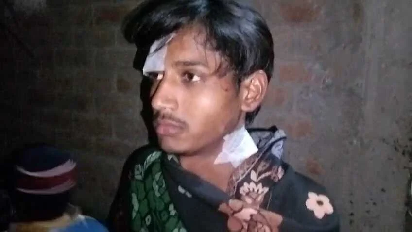 समस्तीपुर में खूनी संघर्ष: वारिसनगर के मोगलानी चक में युवक पर चाकू से ताबड़तोड़ हमला, हालत गंभीर 1