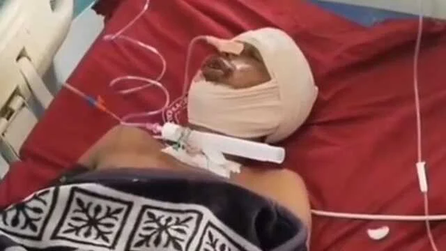 बेगूसराय में जमीन विवाद में किसान के मुंह में सटाकर मारी गोली, जीभ कटी, हालत नाजुक 2